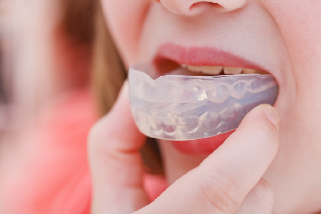 Protecting mouth using mouthguard